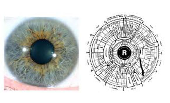 my iridology image 6